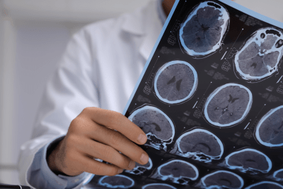 Persoon die een scan van een MRI vasthoudt en bekijkt