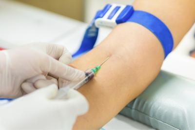 Diagnose NMOSD Bloedonderzoek
