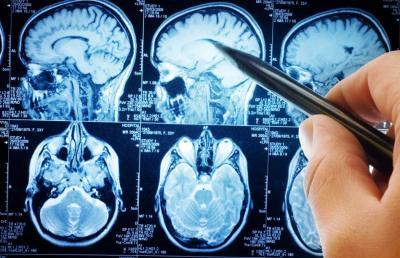 mri-scan