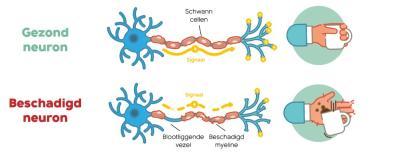 neuron
